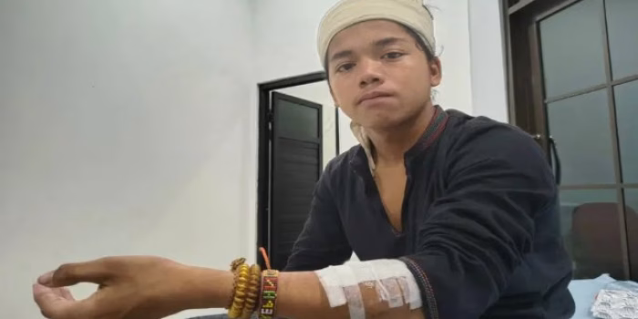 Kesaksian Warga Baduy Dalam Ditolak RS Jakarta Gegara Tak Punya KTP, Luka Begal Nyaris Infeksi Parah!